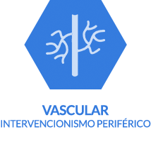 Intervencionismo vascular periférico